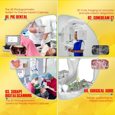 Digital Implant Planning Ho Chi Minh City: The Future Of Precision Dentistry