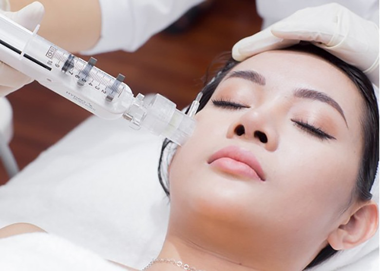 Cấy collagen tươi có tốt không? Tại sao công nghệ này được ưa chuộng hiện nay?