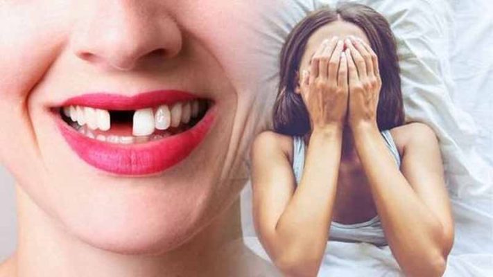 Mơ thấy rụng răng có đáng lo? Hé lộ điềm báo tương lai